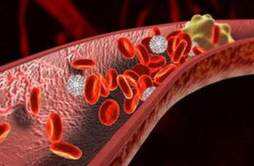 吃什么恢复血管弹性 恢复血管弹性方法