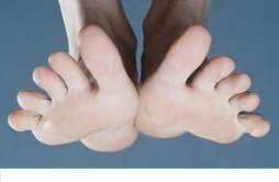 脚趾抽筋是什么原因引起的 脚趾抽筋是什么原因引起的,怎么治疗
