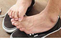 脚气怎么治疗 如何预防脚气