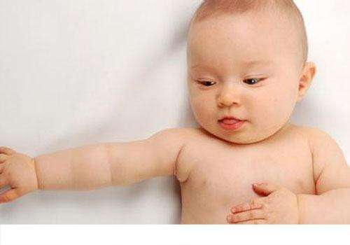 痱子就是湿疹吗 别把痱子当湿疹害了宝宝