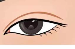 双眼皮疤痕粘连的症状 双眼皮疤痕粘连能修复吗