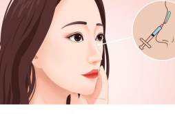 鼻子疤痕挛缩多久才会软化 隆鼻疤痕增生如何消除