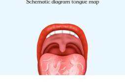 地图舌是脾胃虚弱吗 地图舌是胃气不足吗