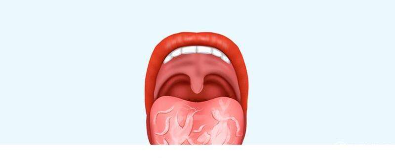 刷舌苔能缓解口臭吗