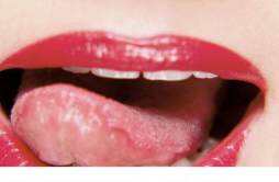 裂纹舌要怎么治疗 裂纹舌要怎么治疗好