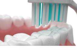 牙齿长牙结石的原因 牙齿长牙结石的原因是什么